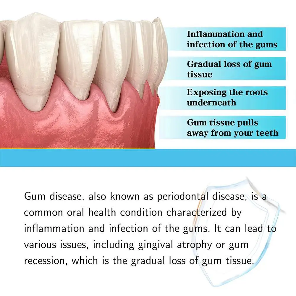 Gengival-Recrescimento Gotas, Reparação Rápida de Cavidades, Cárie, Mousse, Tratamento para Gengivas Recedentes, Rejuvenesça Suas Gengivas com Facilidade