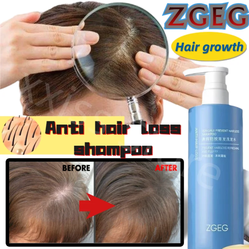 ZGEG Ginger Anti-hair Loss Shampoo Strengthens Hair Anti-hair Loss Oil Control Fluffy Anti-dandruff Shampoo 400ML