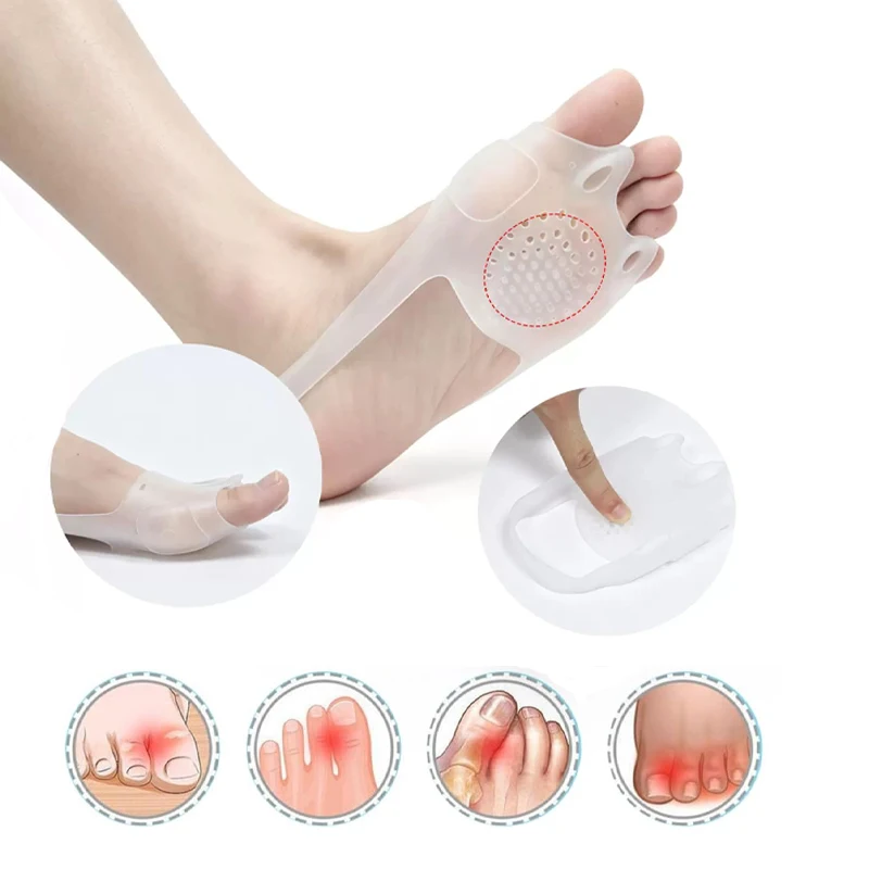 2-Piece Set: Elastic SEBS Toe Separator and Forefoot Pad – Shock-Absorbing, Anti-Chafing, with Elastic Securing Strap