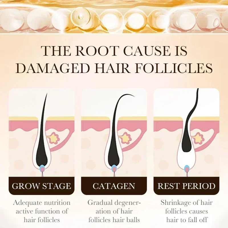 3nd Biotin Hair Nourishing Essence Products Care Scalp Massage Anti Hair Loss Thicker Hair Serum Say Goodbye To Baldness