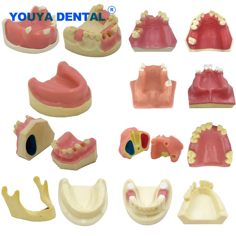 

Dental Implant Teeth Model Practice Study Teach Demonstration Teeth Model For Training Examation Dentist Implant Demo Education