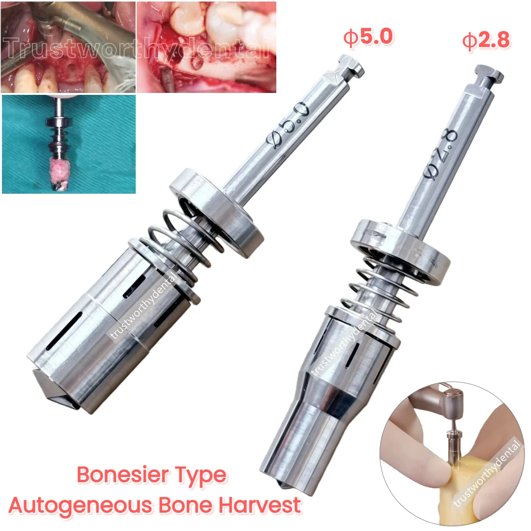

Стоматологическая дрель для сбора костей с автономным сборами и пружинным самошлифовальным порошком для сбора костей, дрель для сбора костей, подходит для Jeil