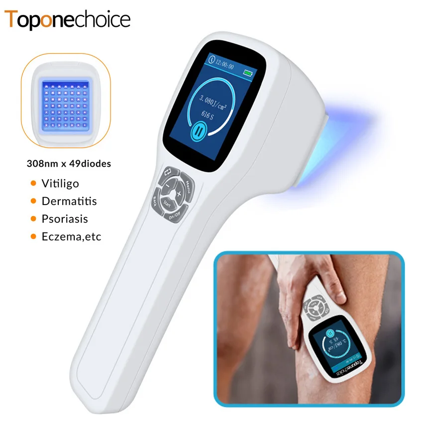 

308nm Ultraviolet Phototherapy Instrument Handheld UVB Lamp Light Therapy for Vitiligo Psoriasis Eczema White Spots Skin Disease