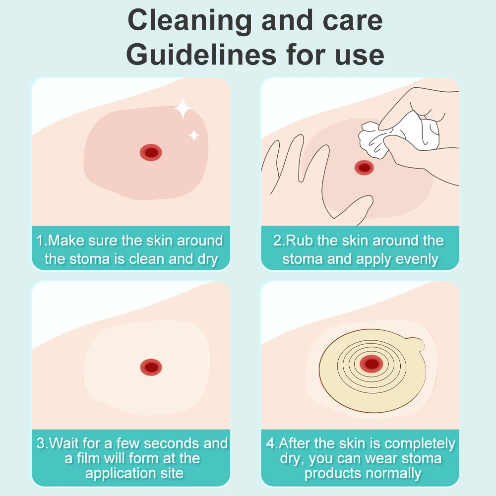 Рисунок 6 - защита кожи от стомы без спирта