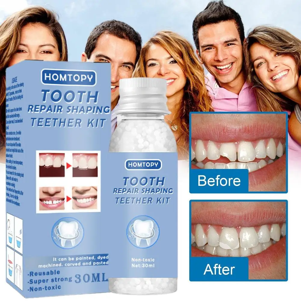 Teeth Repair Glue 30ml for Fixing The Missing and Broken Tooth Replacements Temporary Moldable False Teeth Dental Repair Kit