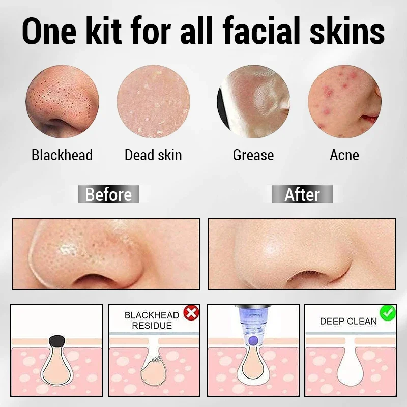 Blackhead Vacuum Remover Face Nose Cleaner T Zone Pore Acne Pimple Removal Vacuum Suction Facial Diamond Beauty Deep Cleaning