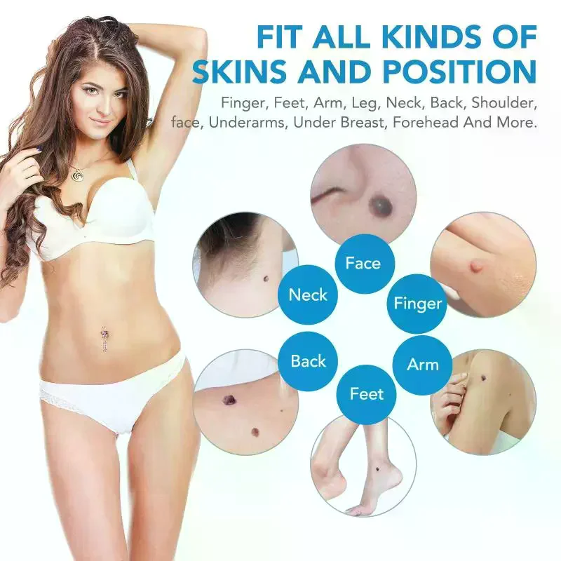 Double Headed Wart Removing Pen Set Auto Skin Tag Remover Painless Mole Wart Remover Skin Tag Removal Kit Skin Care Beauty Tool