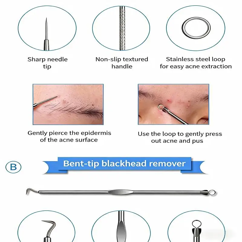 6-teiliges Set zum Entfernen von Mitessern aus Edelstahl – Akne-Nadel, Clip und Lupe für Gesichtsporen, saubere Hautunreinheiten