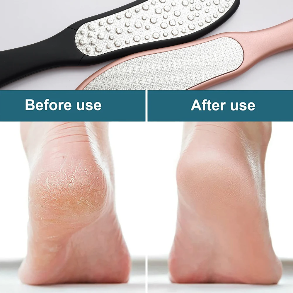 Foot File Double Sided Foot Rasp Callus Corn Remover for Cracked Heel Stainless Steel Professional Foot Care Pedicure Tools