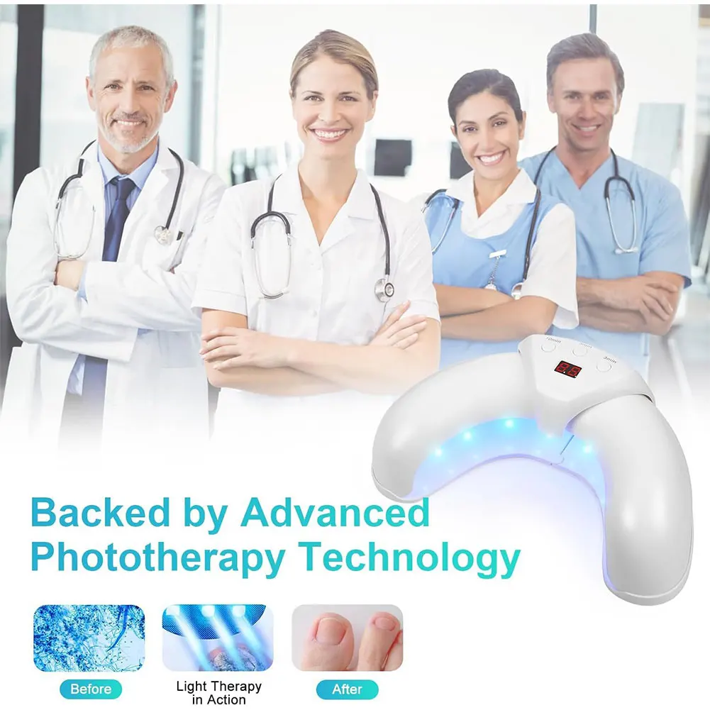 Soluzione per la riparazione delle unghie Dispositivo per la pulizia delle unghie per uso domestico Dispositivo per il trattamento delle unghie a luce blu da 470 nm per unghie dei piedi e delle mani