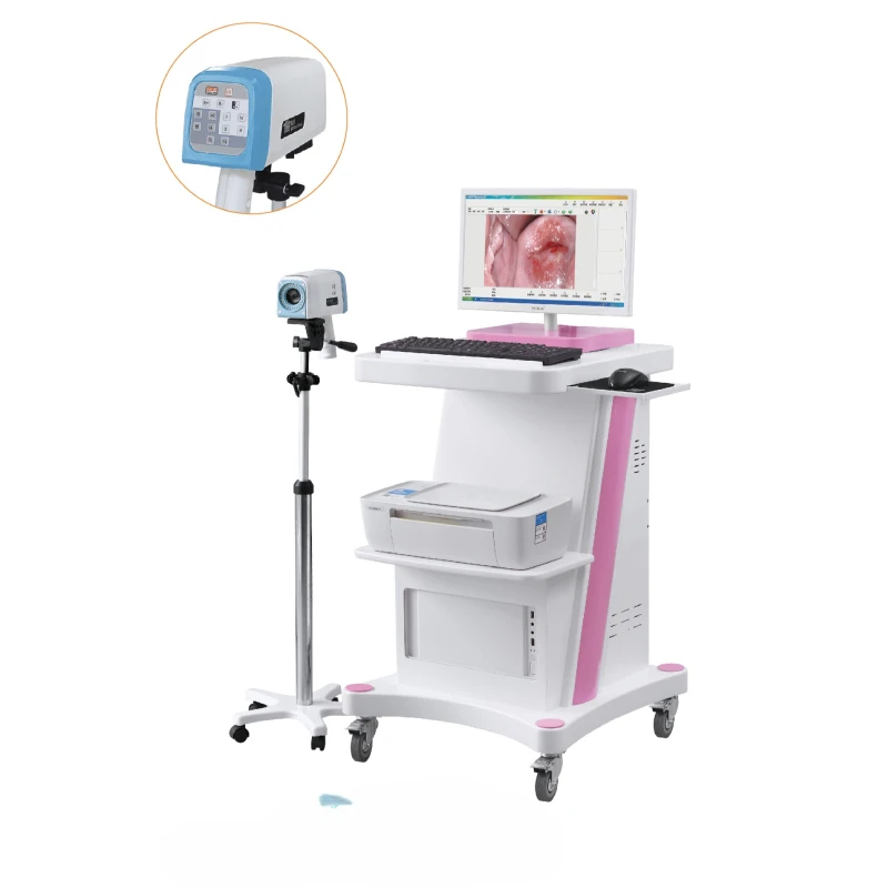 High definition electronic colposcopy LJ-6000C standard high-resolution digital camera with 2 million pixels