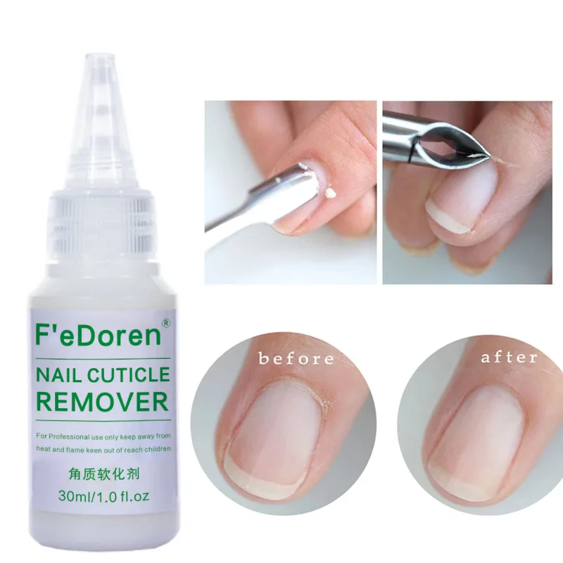 30Ml Nagelriem Verwijderaar Verzachter Vloeibare Exfoliator Cuticula Olie Behandeling Manicure Verzachten Dode Huid Allemaal Voor Manicure Nagels Verzorging