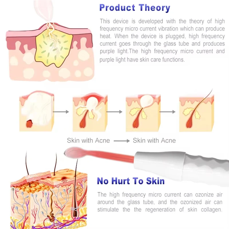 Thumbnail 3 - #47 Best Acne Treatments & Kits to Buy In 2026