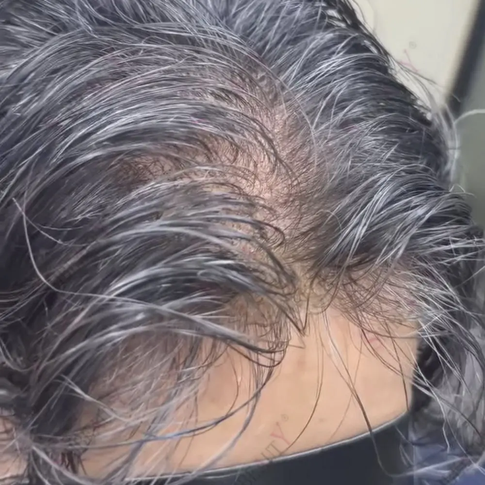 

Супертонкий невидимый мужской парик-накладка V-Loop 0,02 мм, система замещения волос, капилярный протез, 100% натуральные человеческие волосы для мужчин