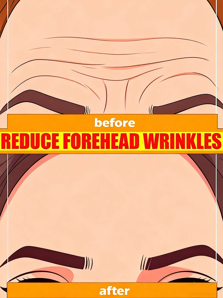 

No wrinkles and No fine lines