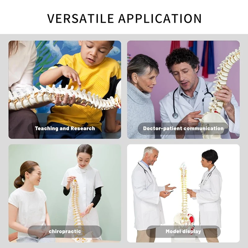 L47A-Spine Model For Anatomy, Arteries, Lumbar Column,Pelvic Girdle Femur With Stand For Science Study Or Patient Education