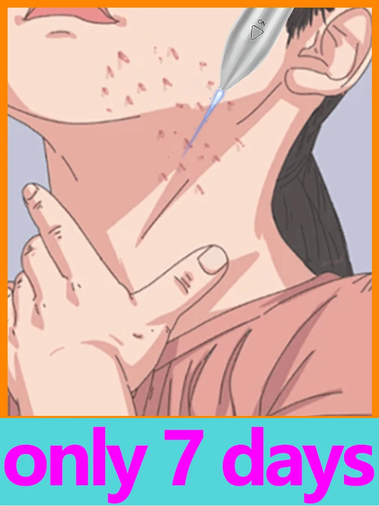 

2025 Новые технологии Лазер и синий светодиодный инструмент Изделить бородавок