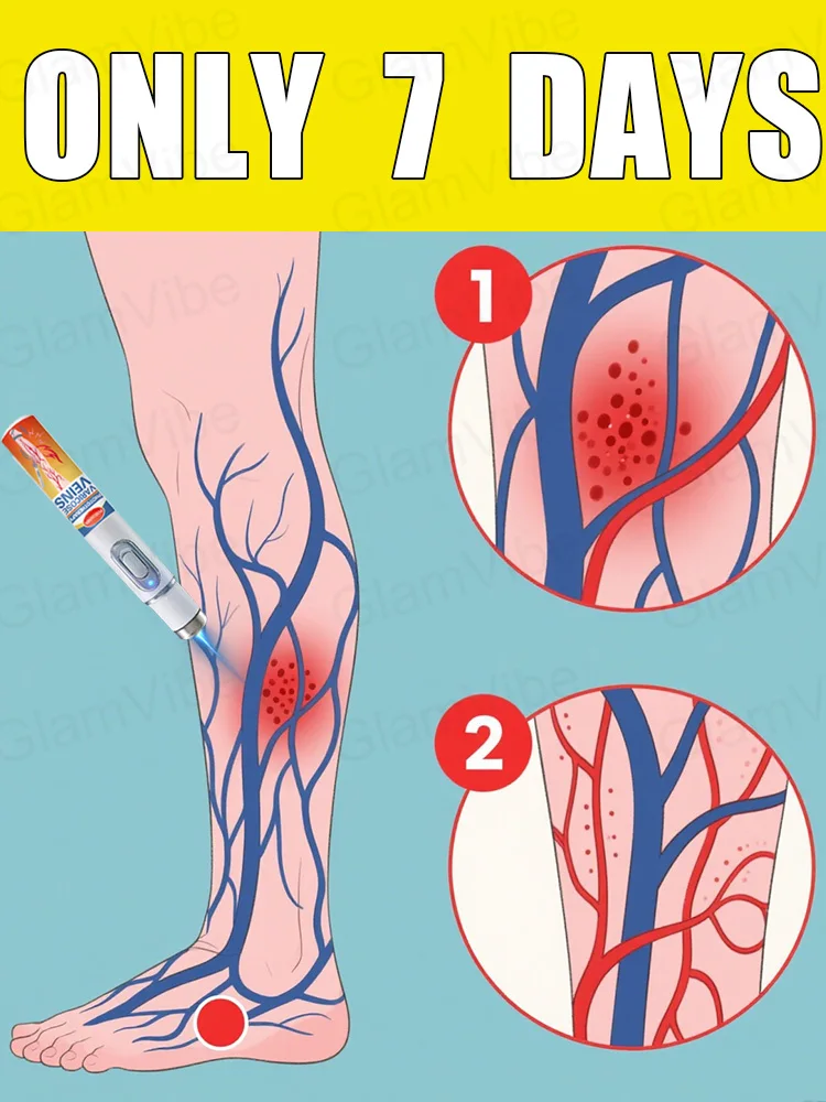 

blue light pen solve varicose veins, hot sale leg care tools