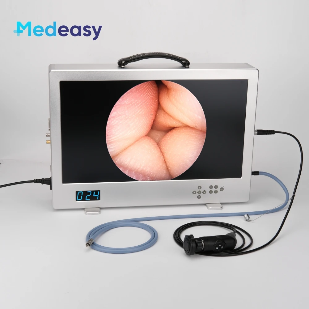 Medical Full HD Endoscope Camera System with 24 Inch Monitor, 80W Led Light Source and Record Function