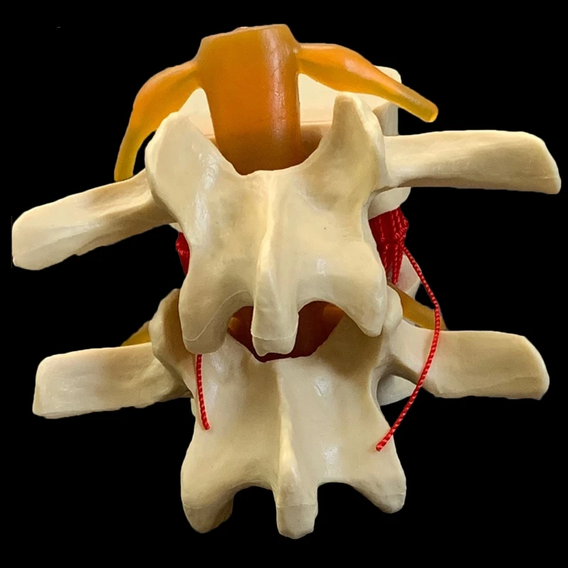 Spine Human Spine Model Full Size Demonstration Model Of Human Lumbar Intervertebral Disc Compression For Medical Teaching