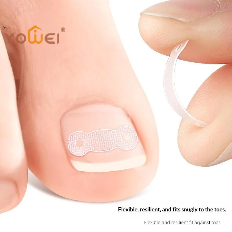 Latest 10Pcs Ingrown Toe Nail  Ingrown Toenail Correction Tool Elastic Patch Sticker Straightening Clip Brace Pedicure Tools