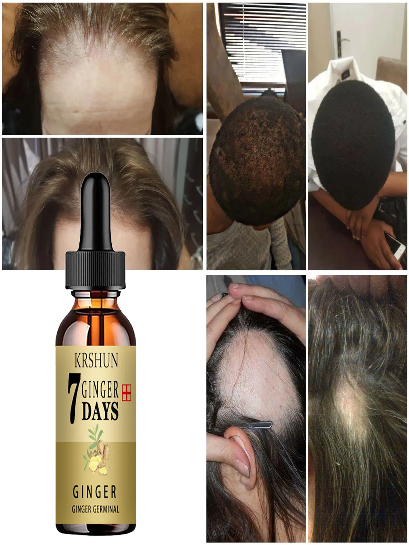 5ML/15ML/30ML/50ML Hair Growth Serum Anti Preventing Hair Loss Alopecia Liquid Damaged Hair Repair Growing Faster