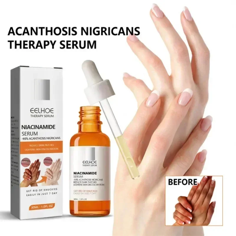 

BHA AHA Dark Knees Elbows Armpit Beaching Serum,Woman Private Part Skin Removal,Dark Knuckles Strong Whitening Serum