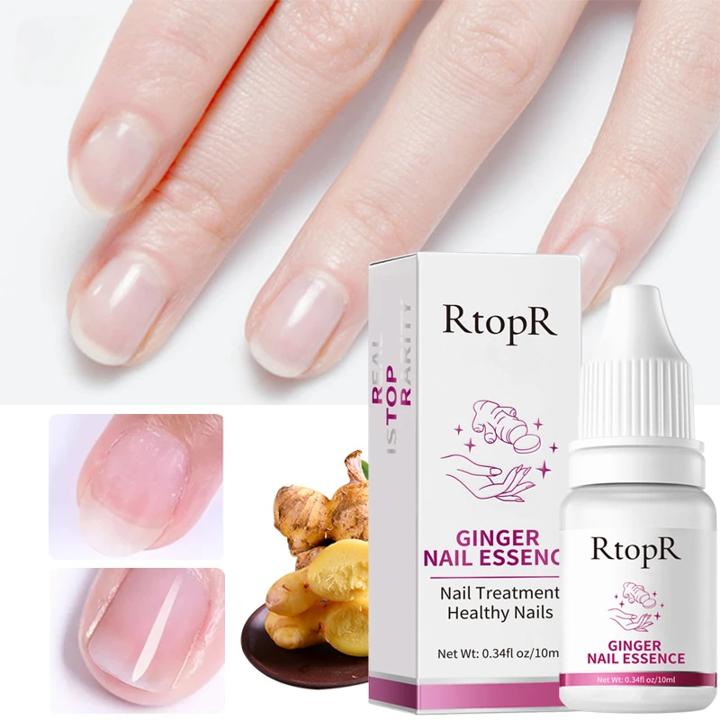 10ml Ginger Nail Essence Nourishing Rough Nails Anti Paronychia Thicken Crack Nail Repair Toenail Infection Treatment Serum