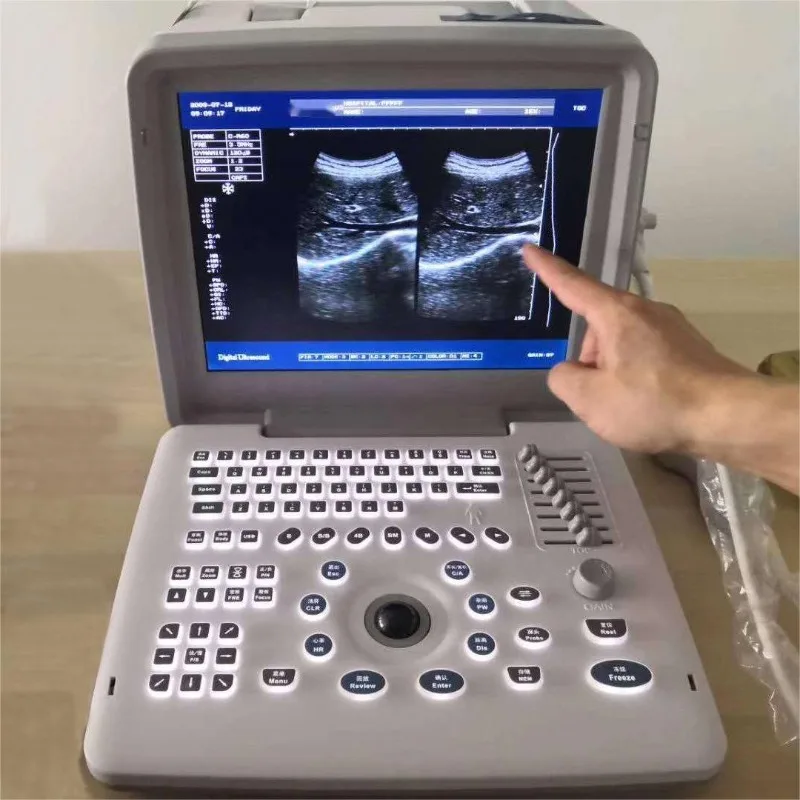 2026 Veterinary Potable Color Ultrasound Doppler Scanner Large Animal Vet Scan Ultrasound Hand Held Machine for Goats