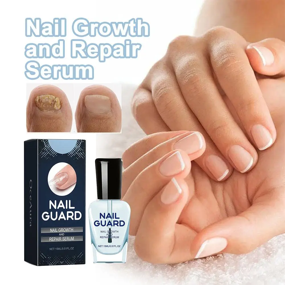 Líquido reparador de unhas para casa, Creme nutritivo nutritivo, Soro reparador de unhas suave e brilhante, cuidados com as unhas dos dedos, U5H0, 15ml