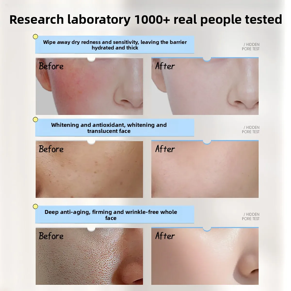كريم الوجه رويي بفيتامين E وال - مراجعة Skincare Niacinamide وسعره