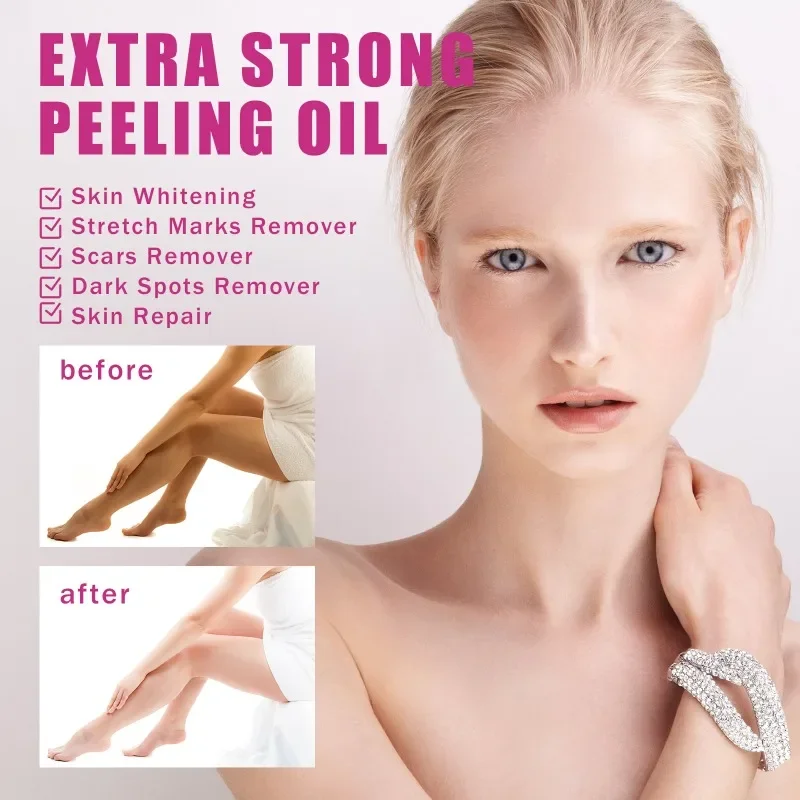 Yellow Peeling Oil Dark Skin Bleaching Remove Arm elbow Knee Legs Melanin Body Brighten Exfoliating Dead Skin Care Whiten Serum