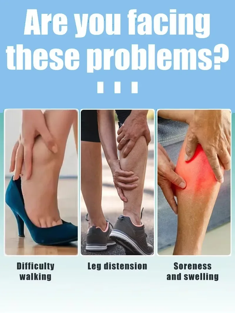 قلم ليزر أزرق مطور حديثًا، يحل الدوالي، مما يسمح لك أن تتمتع بأرجل صحية جديدة 2020 #2