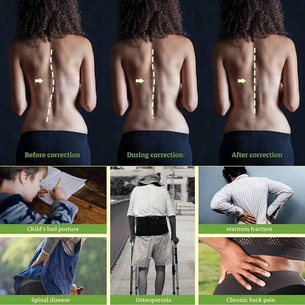 1PCS TLSO Fixed Spinal Brace,Lightweight & Adjustable Back Brace for Adult,Post Surgery Support,Hunchback with Inflatable Airbag