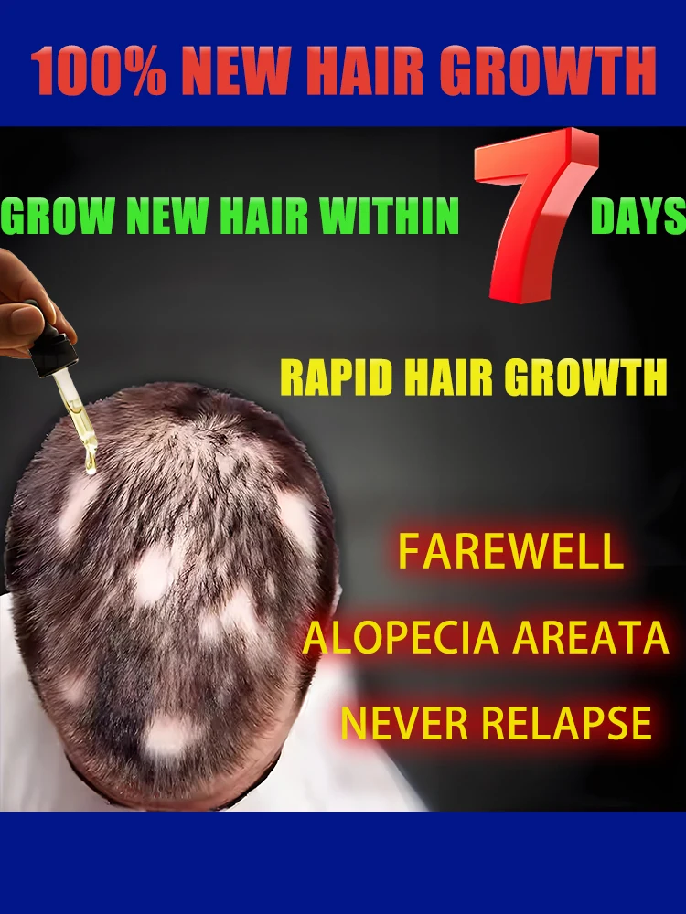 Hᴀɪʀ ɢʀᴏᴡᴛʜ ᴇssᴇɴᴄᴇ ᴛᴏ ᴘʀᴇᴠᴇɴᴛ ʜᴀɪʀ ʟᴏss ᴀɴᴅ ᴏ̨ᴜɪᴄᴋʟʏ ʀᴇɢᴇɴᴇʀᴀᴛᴇ,Hair generating essence