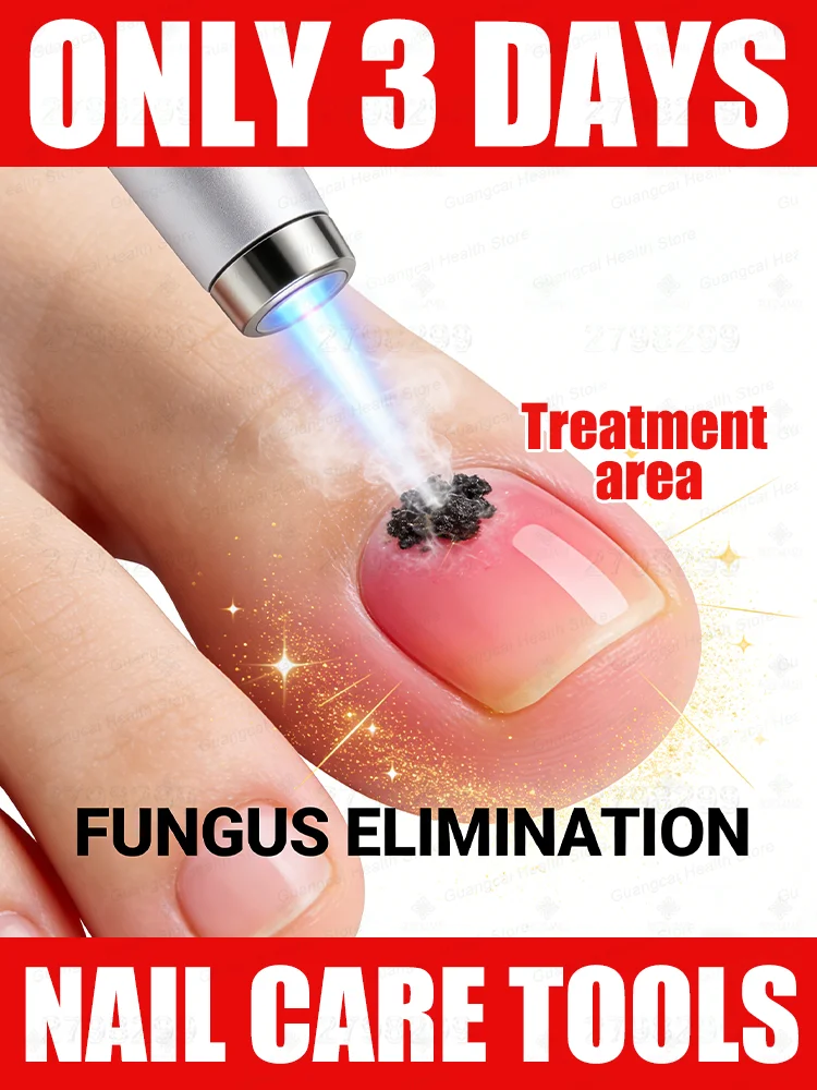 

2025 new Free shipping, Christ Blue light laser pen ᵗʰᵒʳᵒᵘᵍʰˡʸ ʳᵉᵐᵒᵛᵉˢ ᶠᵘⁿᵍⁱ⸴ ᑫᵘⁱᶜᵏˡʸ ᵉˡⁱᵐⁱⁿᵃᵗᵉˢ ᶠᵘⁿᵍⁱ⸴and restores nail health.