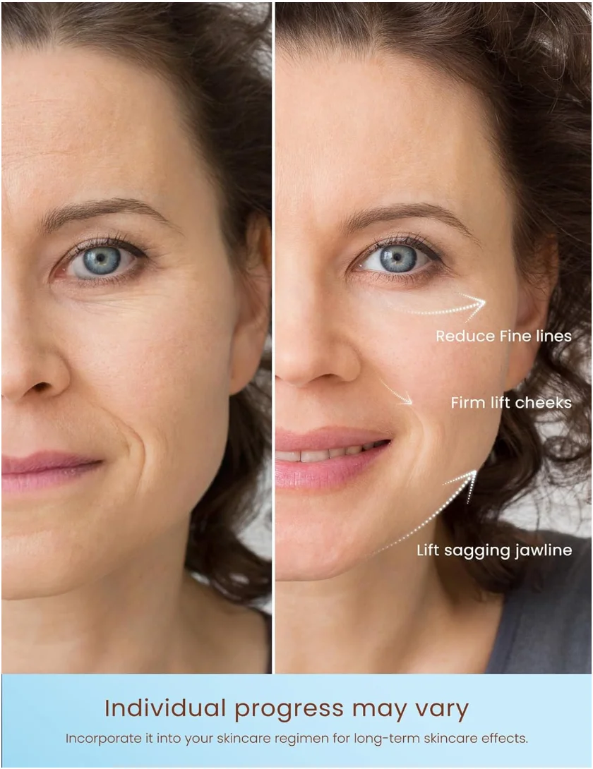 高周波フェイシャルケアマシン USB 目元引き締め しわ除去 フェイスリフティングマッサージャー ボディニキビケア美容機器