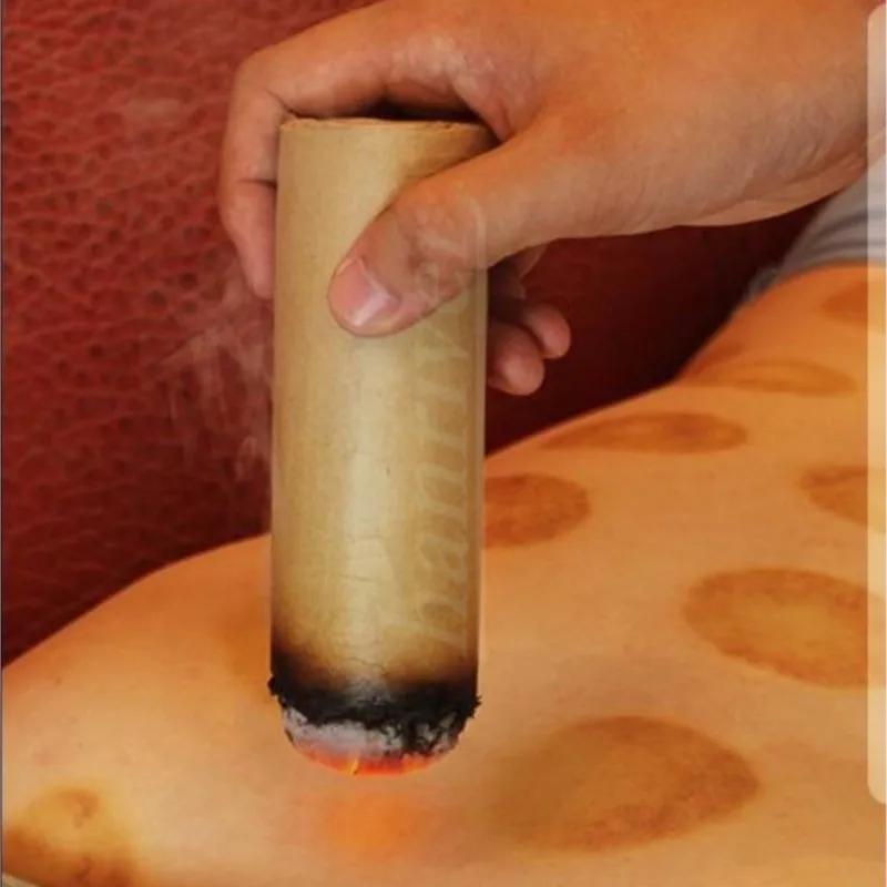 1 piece for three years Chen ai column moxibustion gold moxibustion manual moxibustion with thick moxibustion