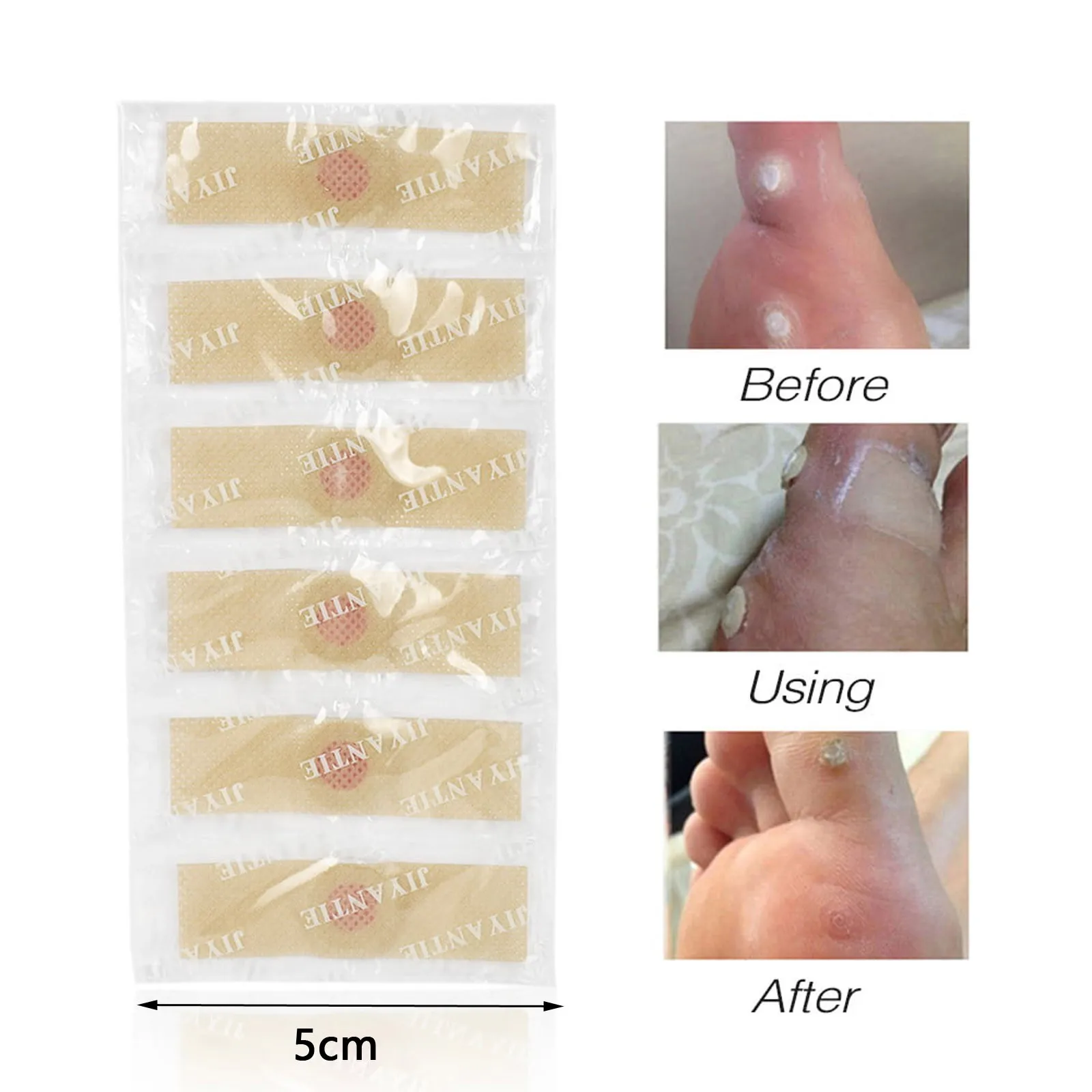 Foot Corn Removal Plaster With Hole Wart Thorn Paste Foot Callus Removal Paste Toe Paste Foot corns removal plaster