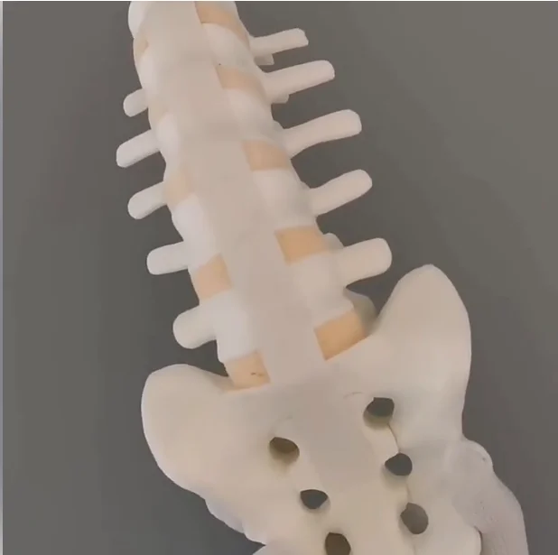 Spine Lumbar Vertebrae Simulation Bone Model, Solid Foam Sawbone from Waist to Sacrum for Surgical Training