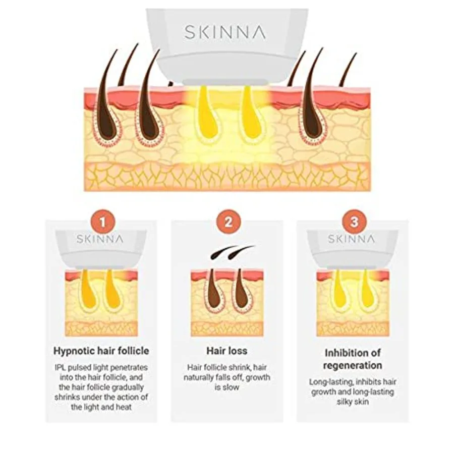 نظام إزالة الشعر بالليزر IPL للاستخدام المنزلي، جهاز تقليل الشعر الدائم للنساء والرجال، إزالة فعالة وغير مؤلمة #3