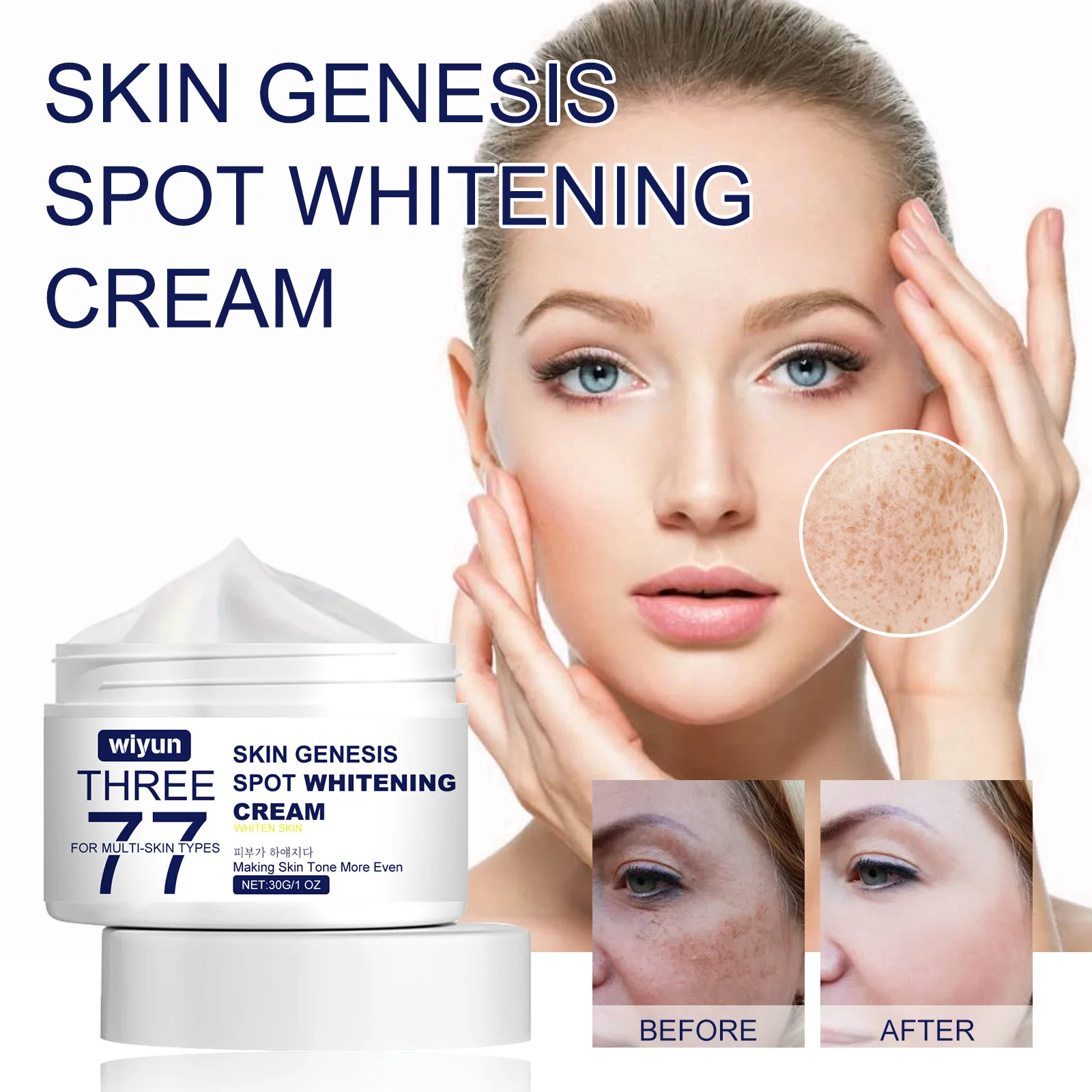 Crème Blanchissante Efficace Contre les Taches de Rousseur, Élimine les Taches Foncées, Pigmentation Fondue, Melasma, Éclaircissante, Soins pour la Peau, 30g