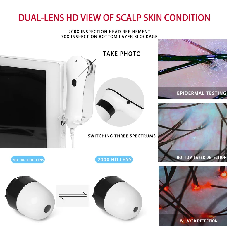 High Definition Skin & Scalp Analyzer Facial Care & Hair Follicle Detection Device for Beauty Clinics