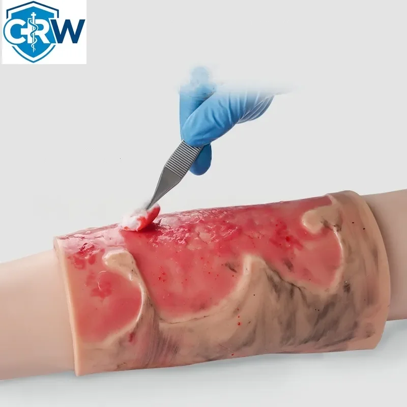 CRW Bestselling Wearable 2-3 Degree Limb Burns Training Module High Simulation Limb Burn Model Medical Student Nurse Training