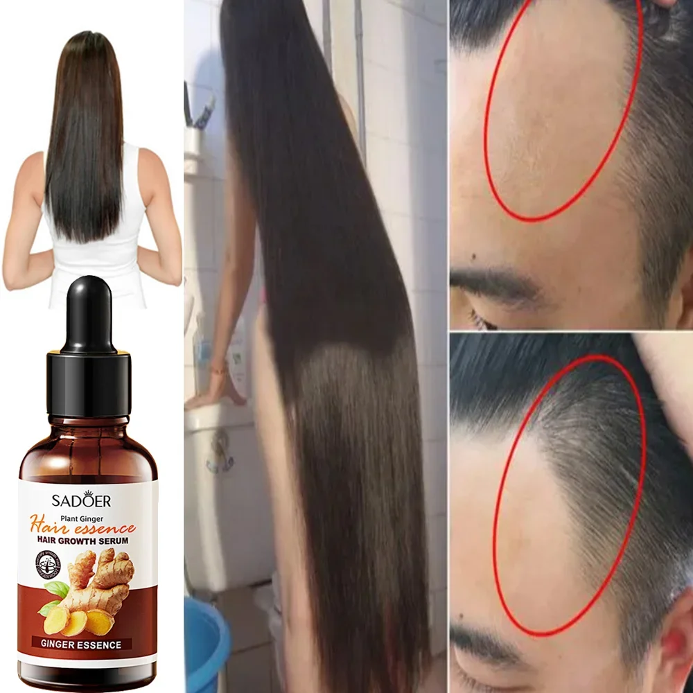 Suero tónico para el crecimiento rápido del cabello para hombres y mujeres, tratamiento para adelgazamiento, anticaída, jengibre, 2024