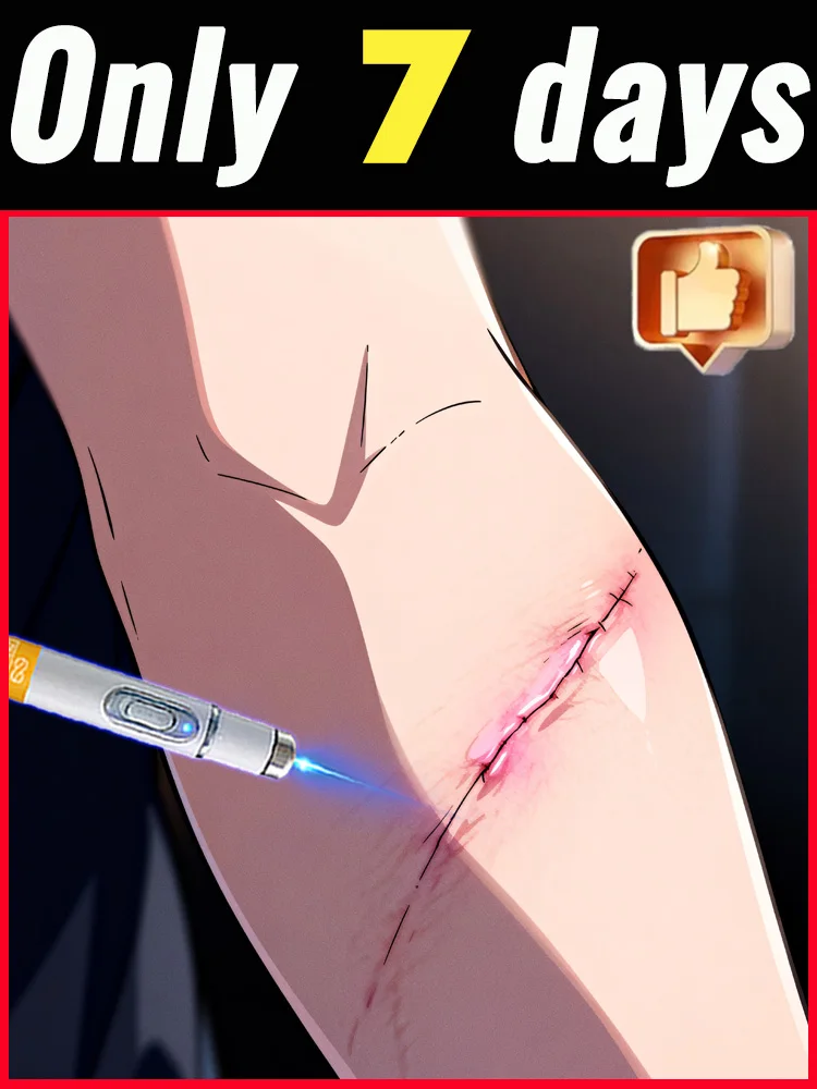 Cicatriz mejorada de tercera generación Reparación de cicatrices raíz uickly