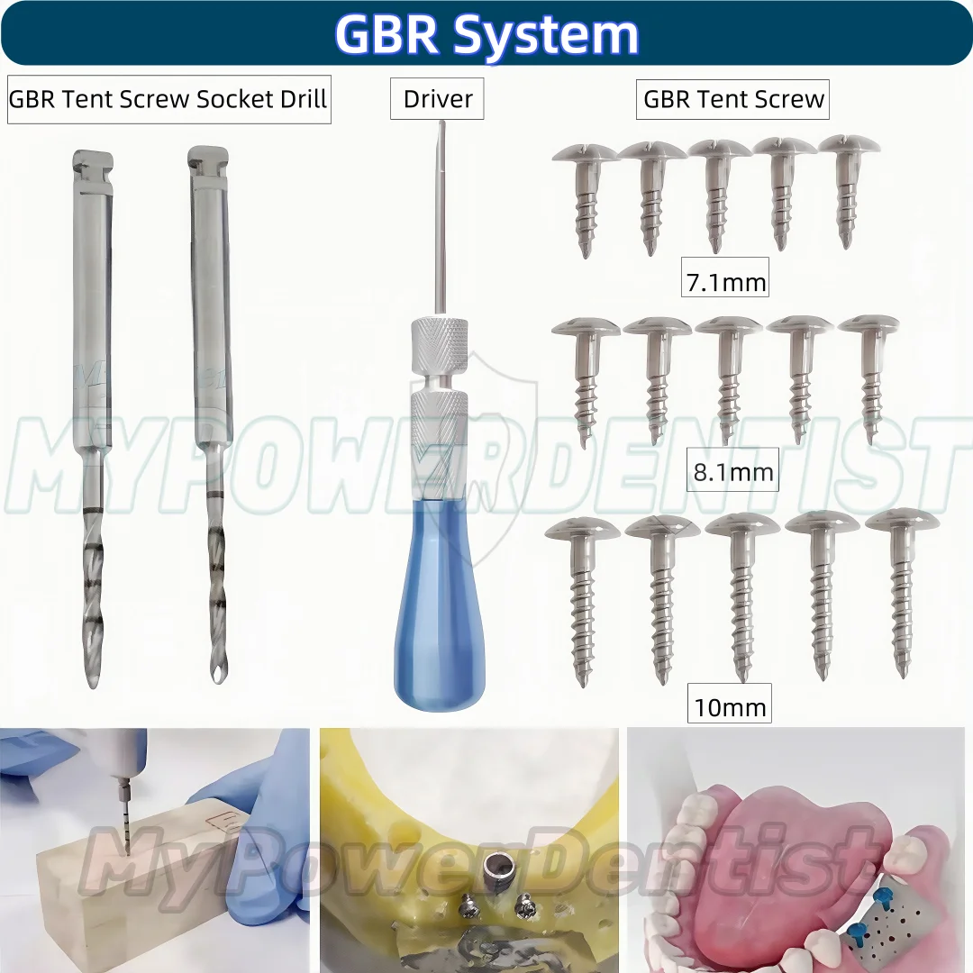 Dental Pilot Drill Bone Screw GBR Tent Screws Insertion Tacks Socket 1.0/1.2