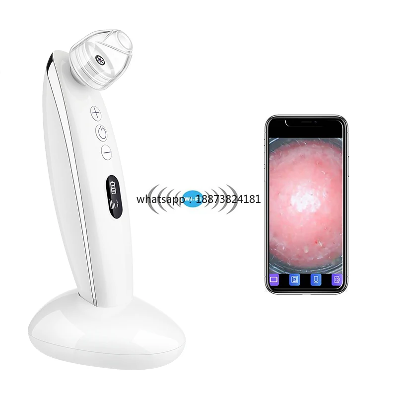 Przenośne, ręczne urządzenie elektryczne do oczyszczania porów i usuwania zaskórników do głębokiego oczyszczania twarzy, szybka wysyłka.