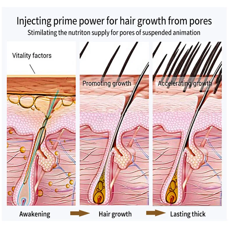 Biotin-Sérum de croissance des cheveux, produits anti-chute de cheveux, Fast Lauren, prévention des frisottis secs, réparation endommagée, traitement du cuir chevelu, spray de soin de la barbe