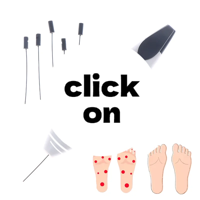 

Медицинский 10 г нейлоновый диабетический монофильный сенсорный тестер, игла для нерва кожи, эндокринологическая нейрологическая диагностическая ручка